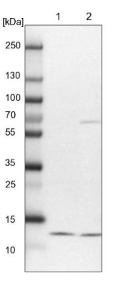 Western Blot: NDUFA5 Antibody [NBP1-88933] - Lane 1: NIH-3T3 cell lysate (Mouse embryonic fibroblast cells)<br/>Lane 2: NBT-II cell lysate (Rat Wistar bladder tumour cells)