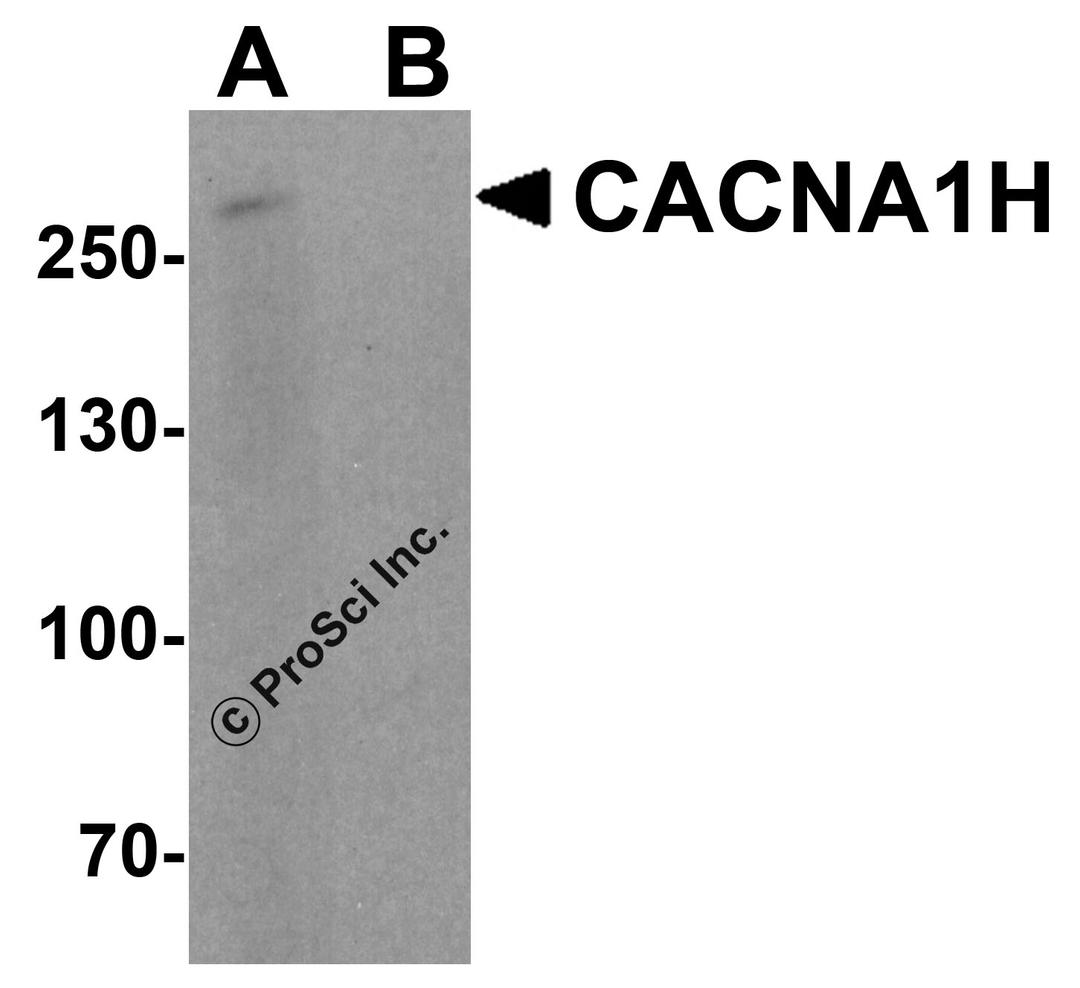Western blot analysis of CACNA1H in 293 cell lysate with CACNA1H antibody at 1 μg/ml in (A) the absence and (B) the presence of blocking peptide.