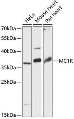 Western blot - MC1R antibody (A13152)