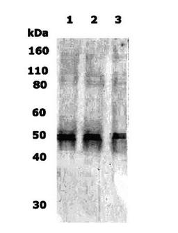 Western Blot: Delta Opioid Receptor Antibody [NB110-79877] - WB detection of Delta Opioid Receptor in 10ug of human brain lysate (lane 1), rat brain lysate (lane 2) and mouse brain lysate (lane 3) with antibody NB110-79877 at a dilution of 1:500.