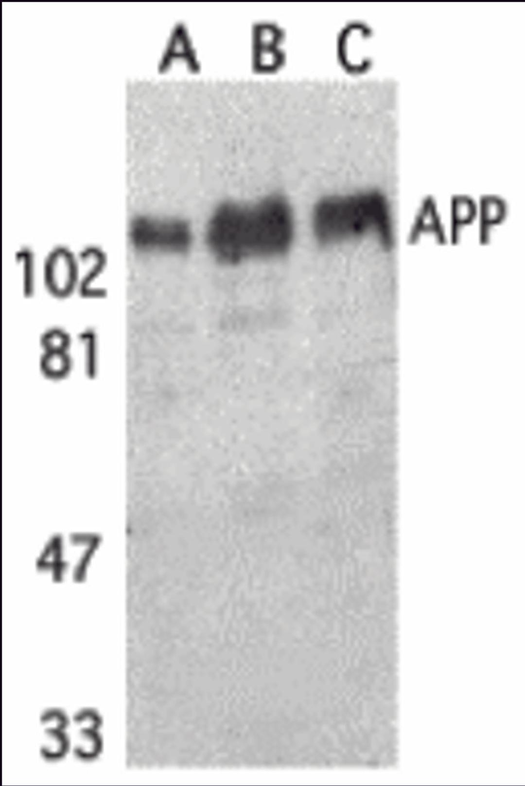 Western blot analysis of APP in (A) human, (B) mouse, and (C) rat brain tissue lysates with APP antibody at 1 μg/mL.