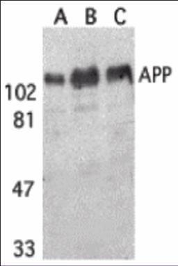 Western blot analysis of APP in (A) human, (B) mouse, and (C) rat brain tissue lysates with APP antibody at 1 μg/mL.
