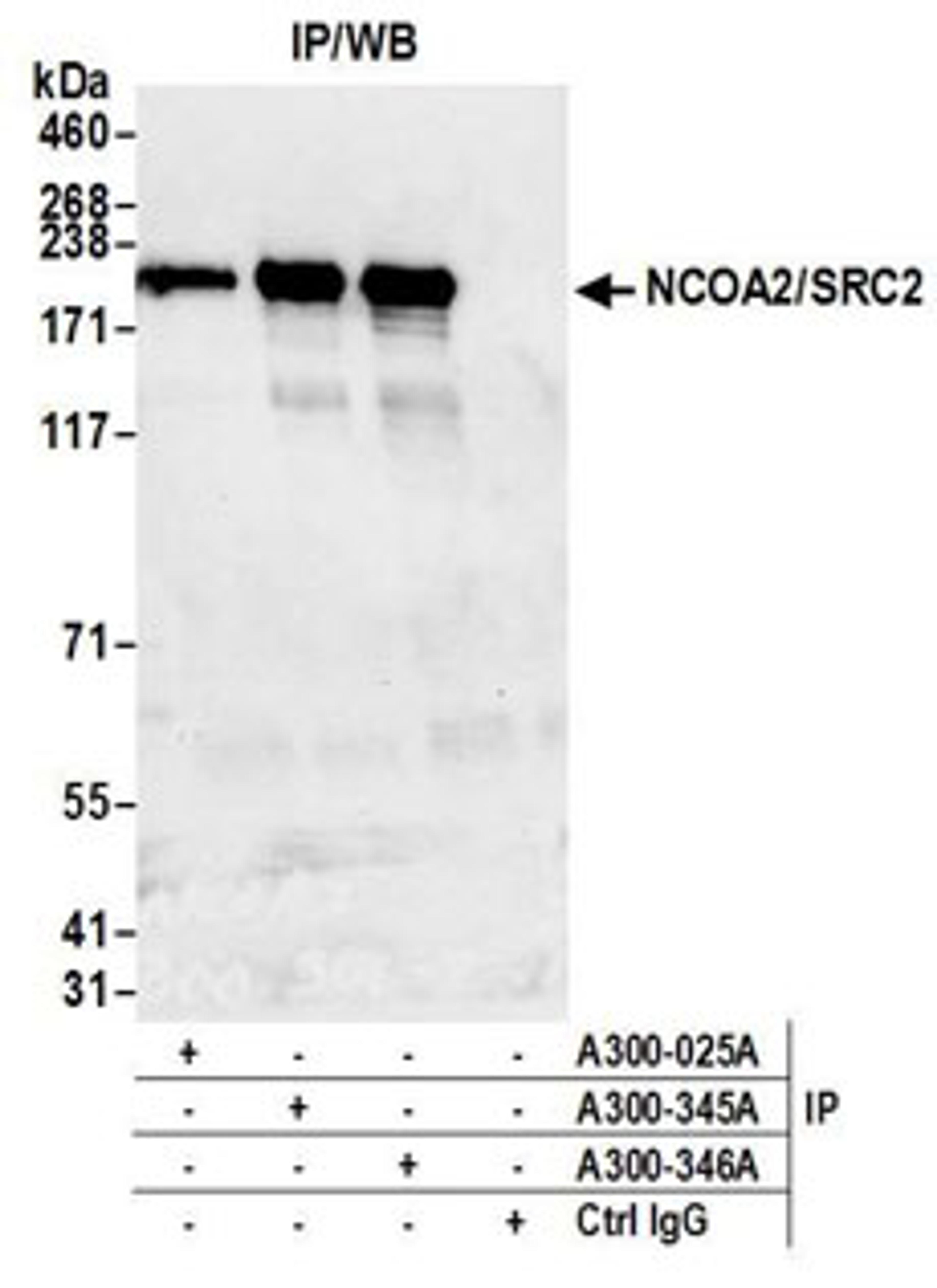 Detection of human NCOA2/SRC2 by western blot of immunoprecipitates.