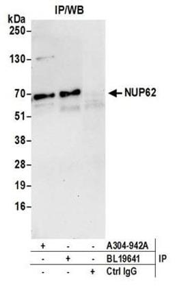 Detection of human NUP62 by western blot of immunoprecipitates.