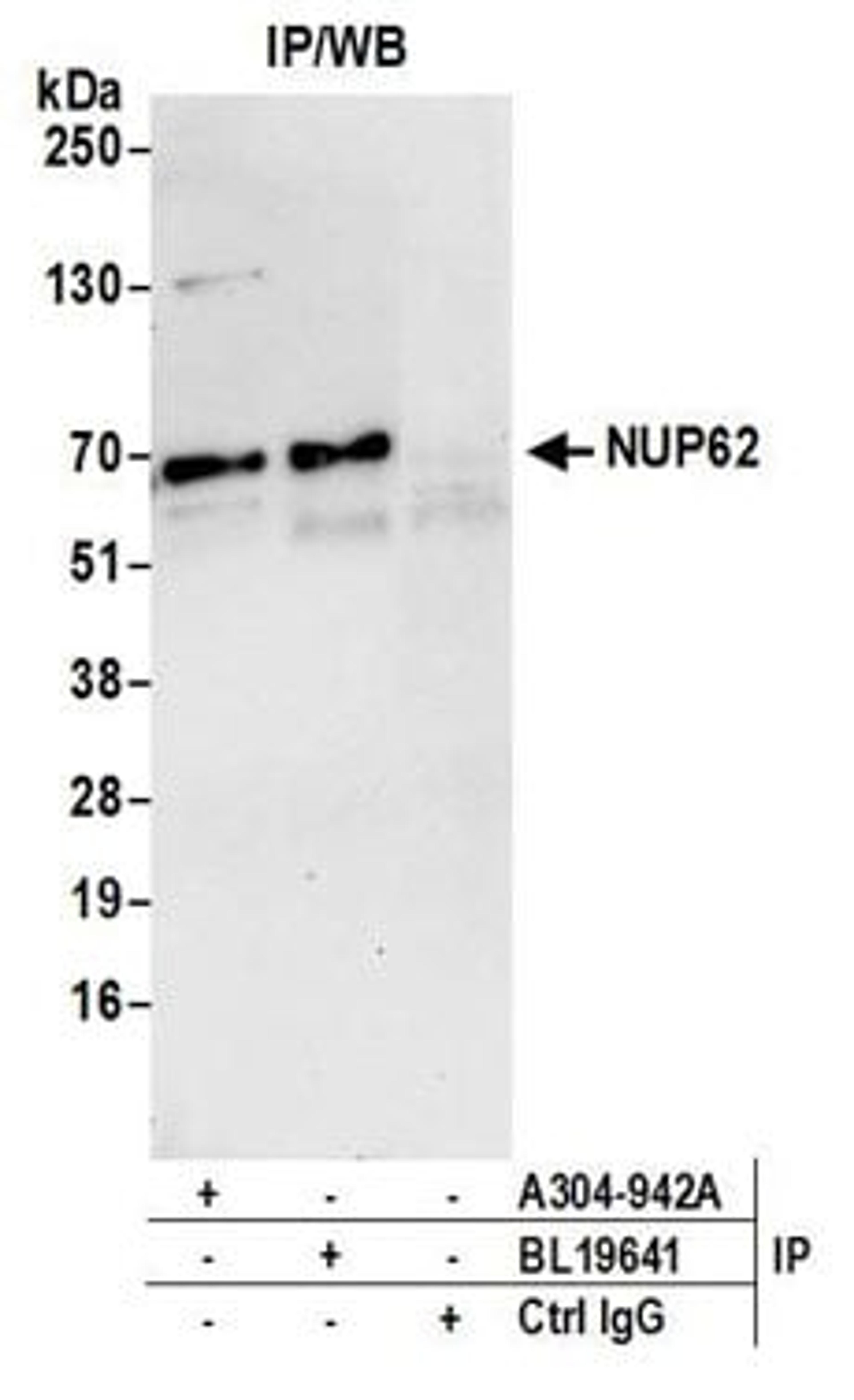 Detection of human NUP62 by western blot of immunoprecipitates.