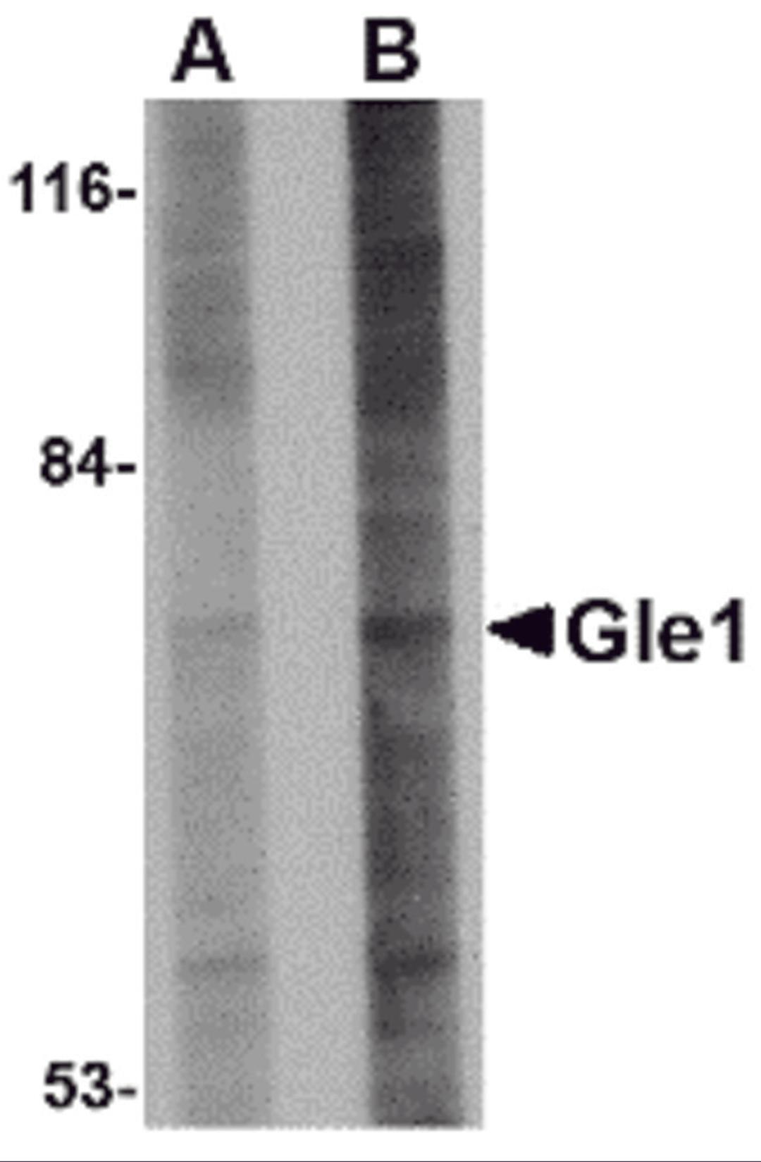 Western blot analysis of Gle1 in 293 cell lysate with Gle1 antibody at (A) 1 and (B) 2 &#956;g/mL.