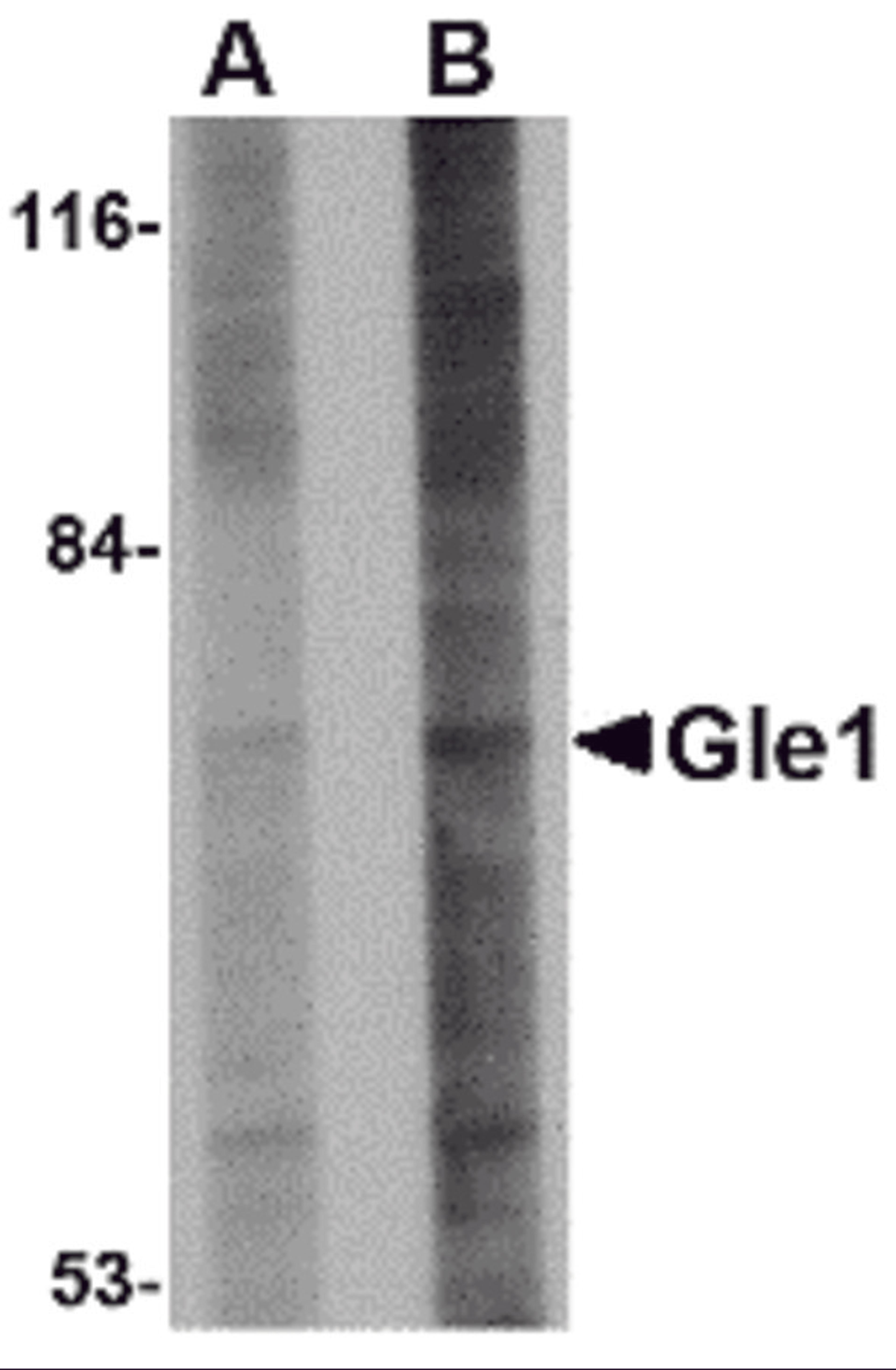 Western blot analysis of Gle1 in 293 cell lysate with Gle1 antibody at (A) 1 and (B) 2 μg/mL.