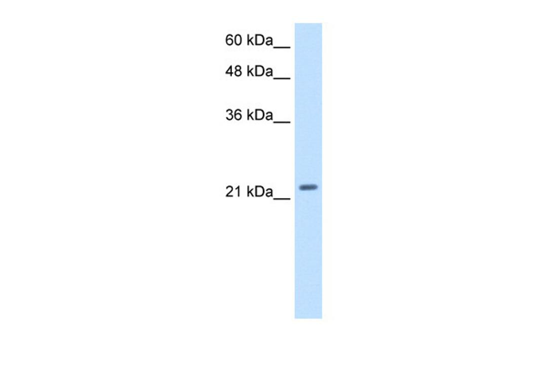 Antibody used in WB on Transfected 293T cell lysates at 2.5 ug/ml.