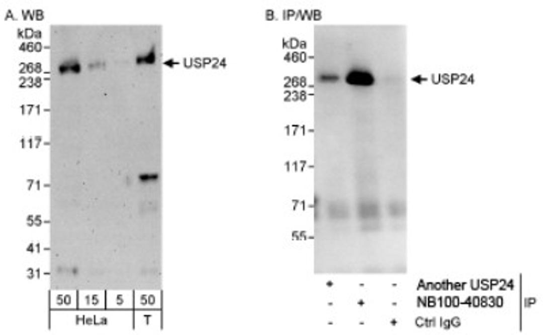 Western Blot: USP24 Antibody [NB100-40830] - Detection of Human USP24 on HeLa whole cell lysate using NB100-40830. USP24 was also immunoprecipitated by another rabbit anti-USP24 antibody.