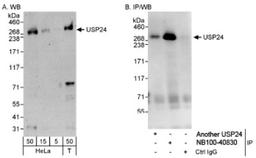 Western Blot: USP24 Antibody [NB100-40830] - Detection of Human USP24 on HeLa whole cell lysate using NB100-40830. USP24 was also immunoprecipitated by another rabbit anti-USP24 antibody.