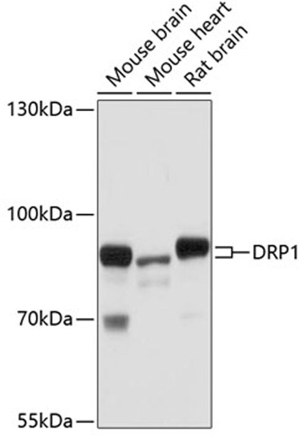 Western blot - DRP1 antibody (A17069)