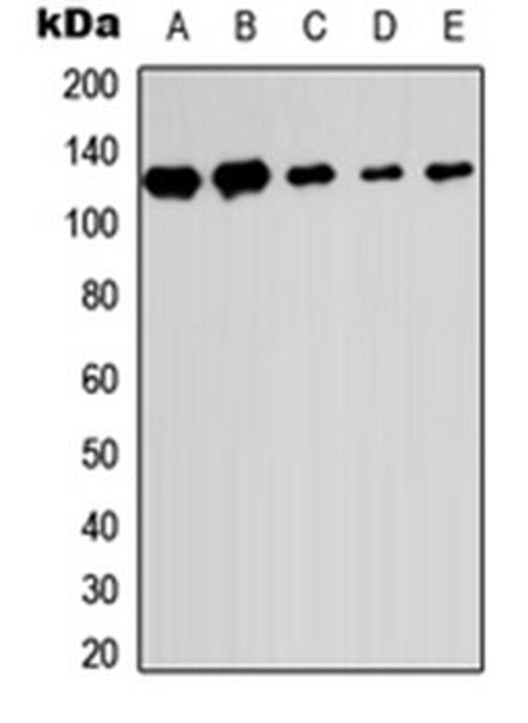 Western blot analysis of HEK293T (Lane 1), Raw264.7 (Lane 2), H9C2 (Lane 3), HeLa (Lane 4), HL60 (Lane 5) whole cell lysates using SENP6 antibody