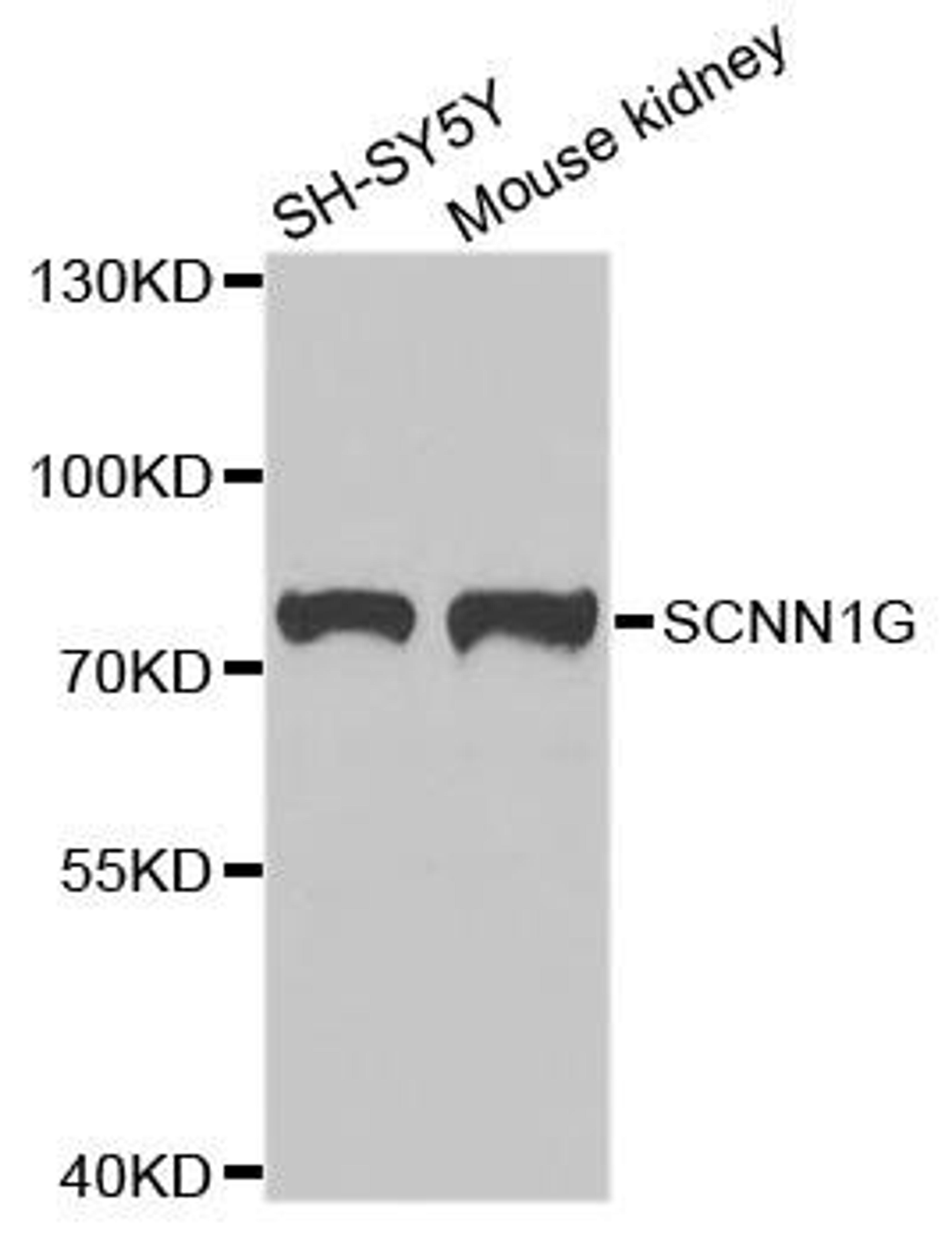 Western blot analysis of extracts of various cell lines using SCNN1G antibody