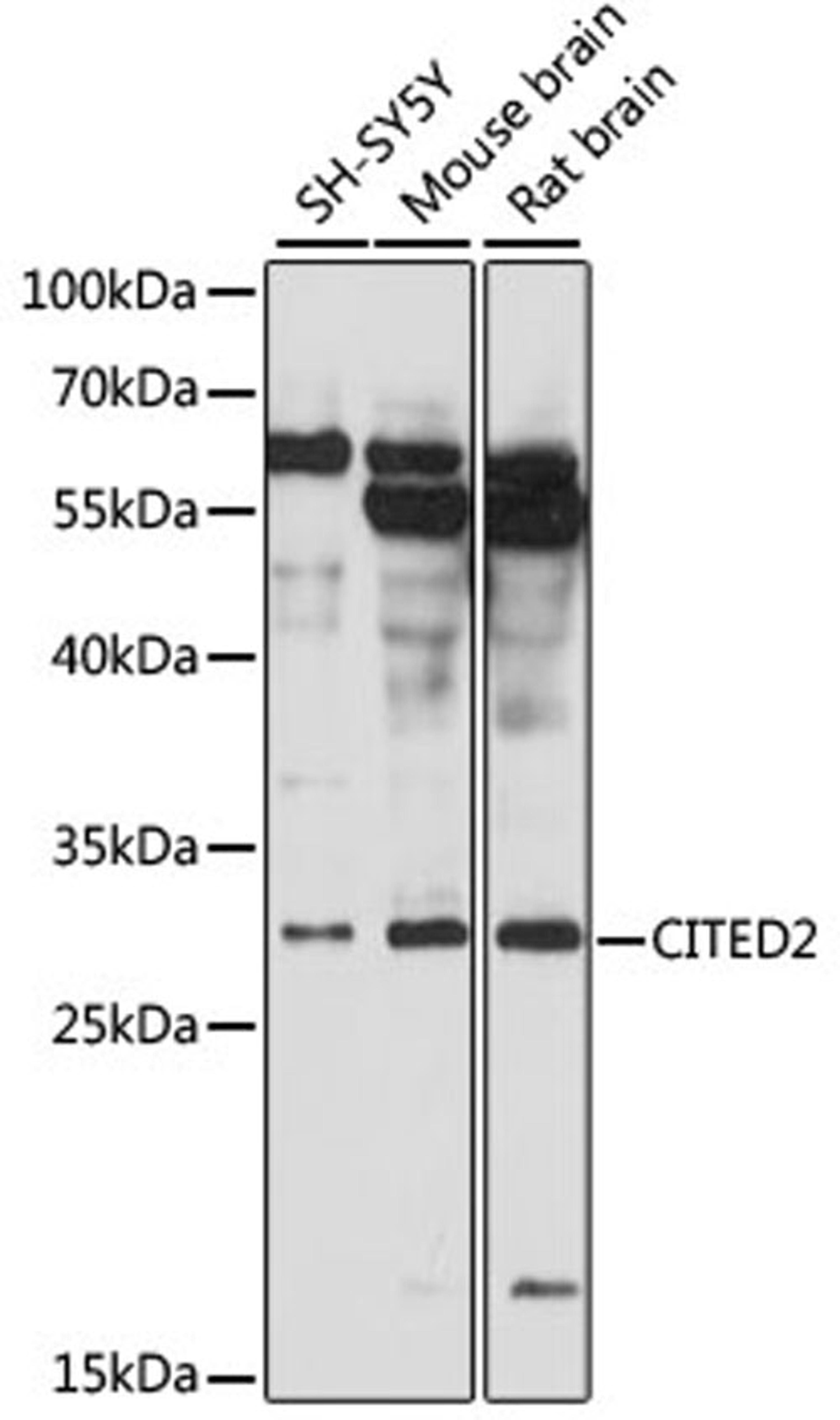 Western blot - CITED2 antibody (A12831)