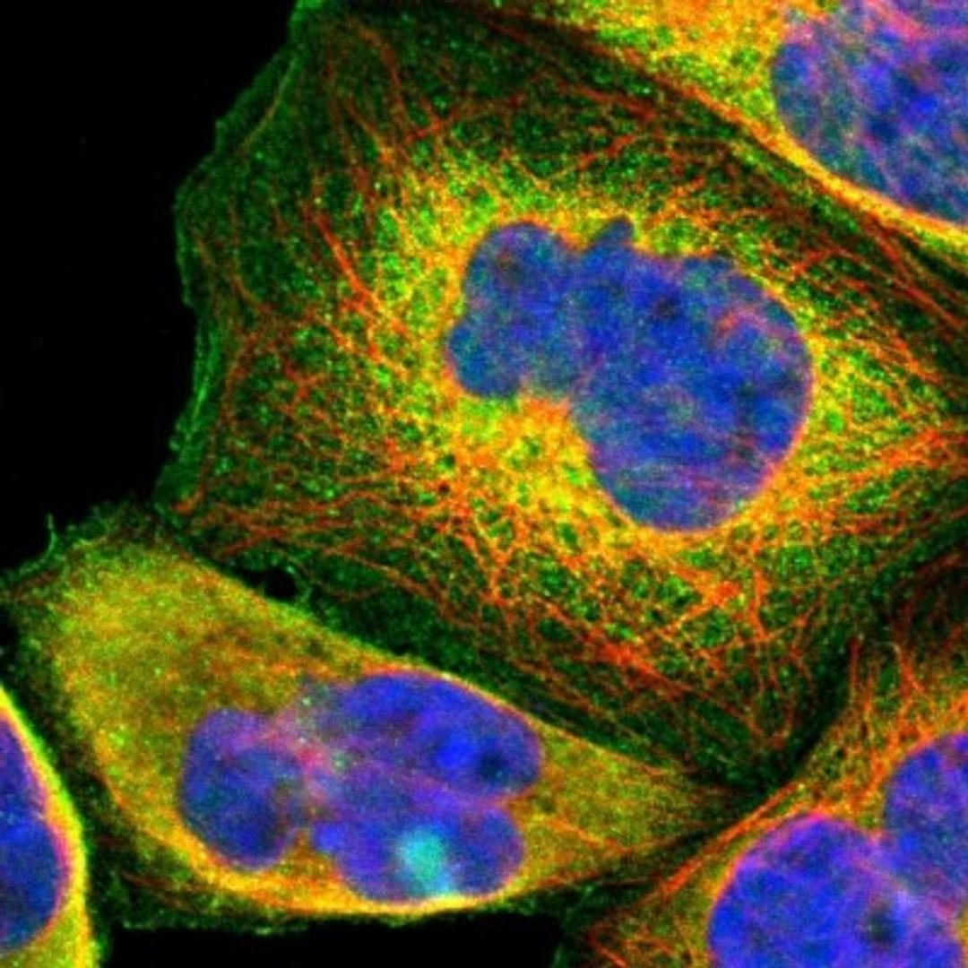 Immunocytochemistry/Immunofluorescence: USP2 Antibody [NBP1-86883] - Immunofluorescent staining of human cell line A-431 shows positivity in plasma membrane & cytoplasm.