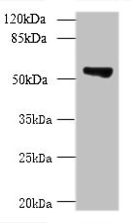 Western blot. All lanes: TCP11L2 antibody at 1µg/ml + A549 whole cell lysate. Secondary. Goat polyclonal to rabbit at 1/10000 dilution. Predicted band size: 59, 30 kDa. Observed band size: 59 kDa