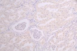 IHC image of CSB-RA858415MA1HU diluted at 1:100 and staining in paraffin-embedded human kidney tissue performed on a Leica BondTM system. After dewaxing and hydration, antigen retrieval was mediated by high pressure in a citrate buffer (pH 6.0). Section was blocked with 10% normal goat serum 30min at RT. Then primary antibody (1% BSA) was incubated at 4°C overnight. The primary is detected by a Goat anti-human polymer IgG labeled by HRP and visualized using 0.05% DAB.