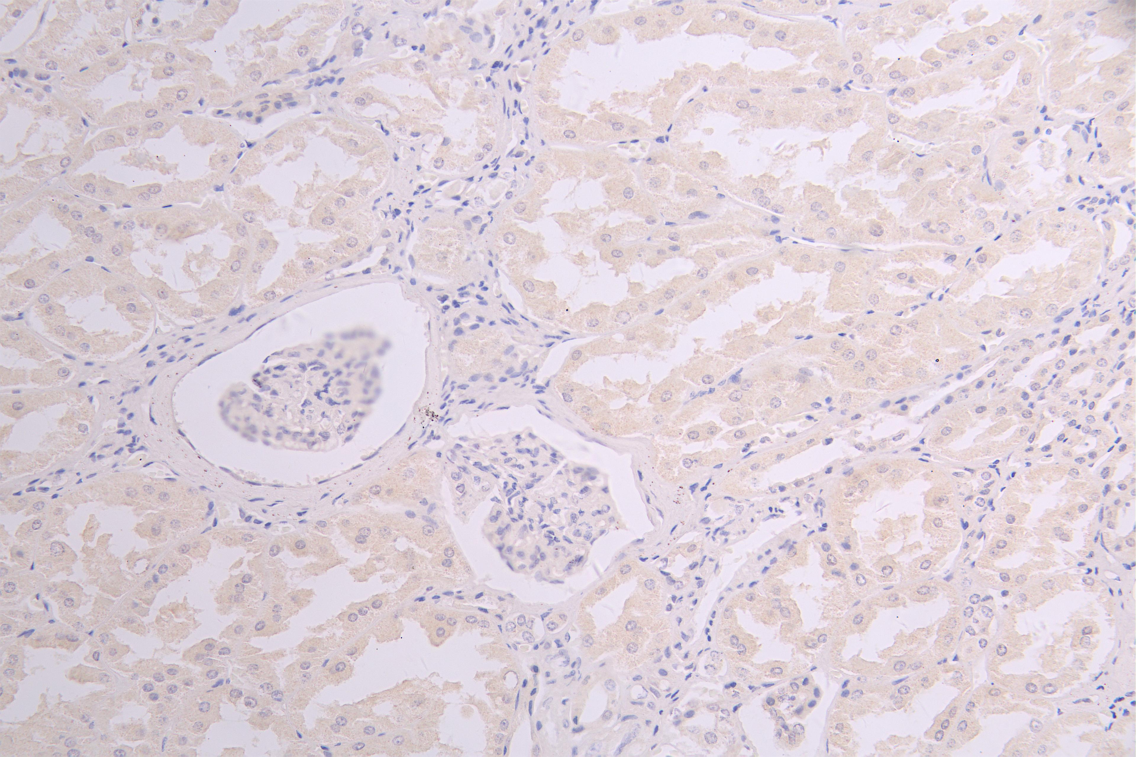 IHC image of CSB-RA858415MA1HU diluted at 1:100 and staining in paraffin-embedded human kidney tissue performed on a Leica BondTM system. After dewaxing and hydration, antigen retrieval was mediated by high pressure in a citrate buffer (pH 6.0). Section was blocked with 10% normal goat serum 30min at RT. Then primary antibody (1% BSA) was incubated at 4°C overnight. The primary is detected by a Goat anti-human polymer IgG labeled by HRP and visualized using 0.05% DAB.