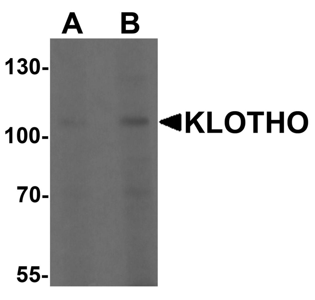 Western blot analysis of KLOTHO in HepG2 cell lysate with KLOTHO antibody at (A) 1 and (B) 2 &#956;g/mL.