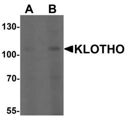 Western blot analysis of KLOTHO in HepG2 cell lysate with KLOTHO antibody at (A) 1 and (B) 2 &#956;g/mL.