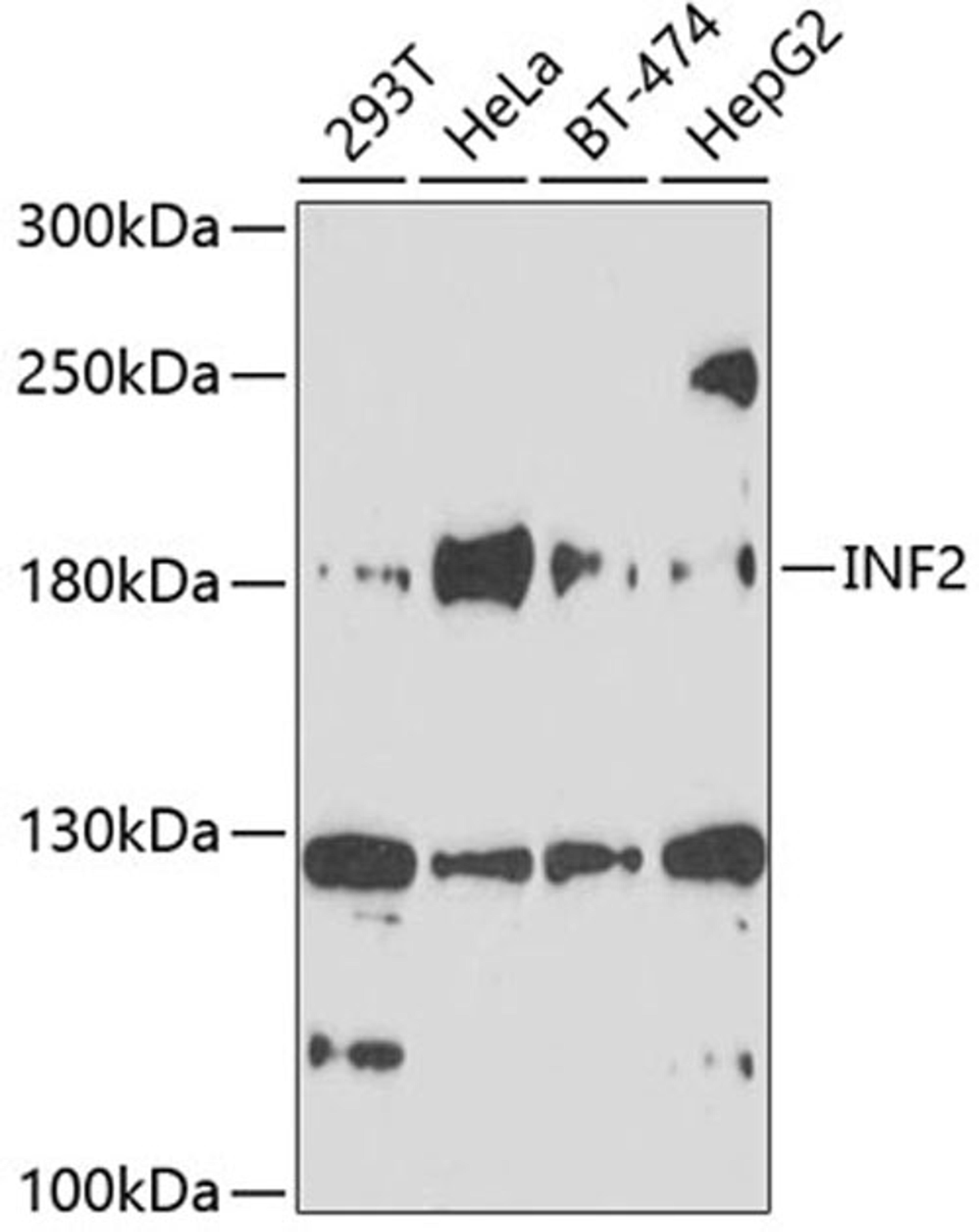 Western blot - INF2 antibody (A10038)