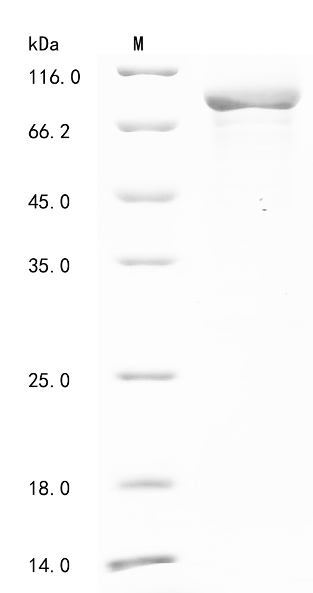 (Tris-Glycine gel) Discontinuous SDS-PAGE (reduced) with 5% enrichment gel and 15% separation gel.
