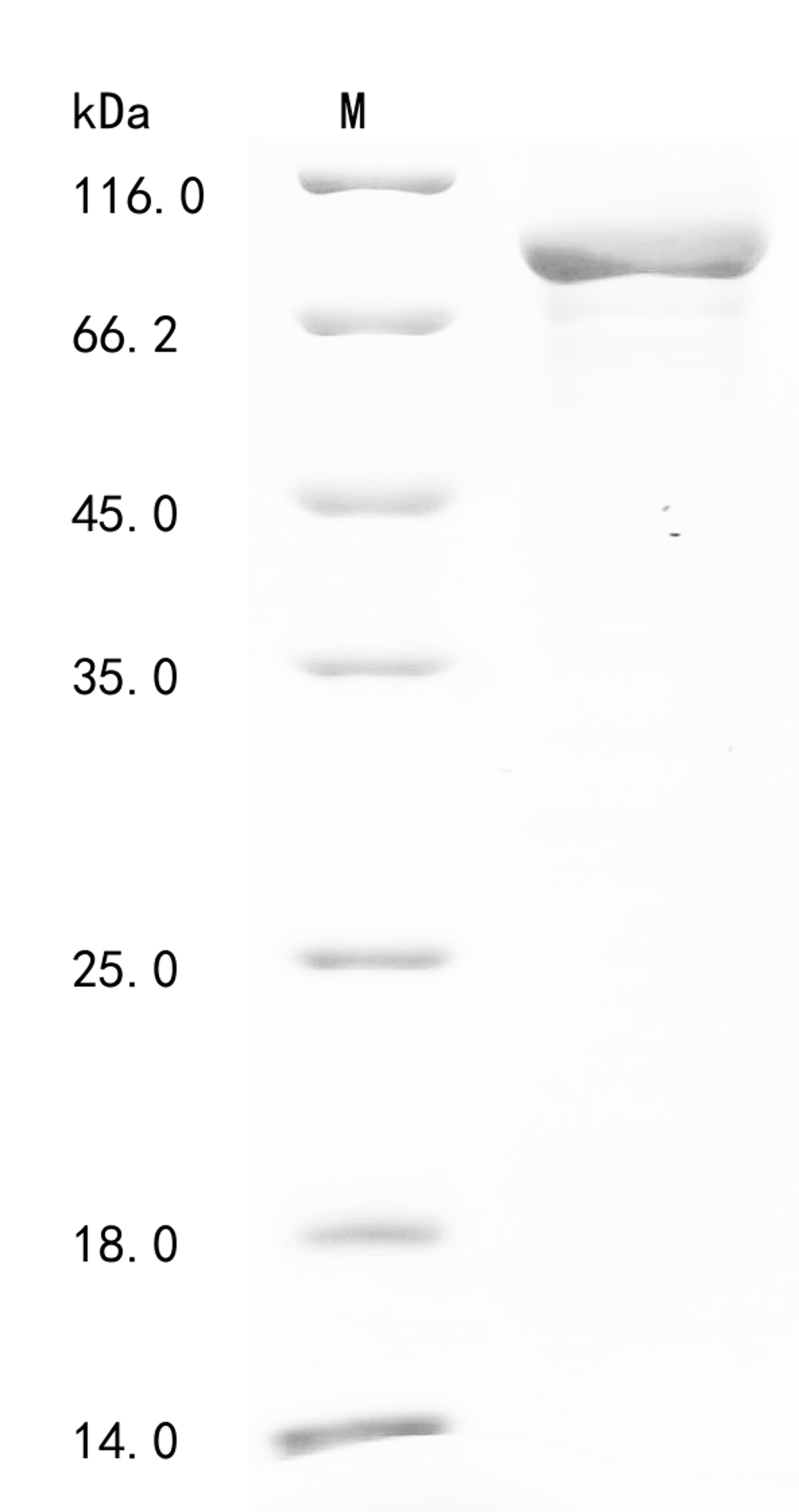 (Tris-Glycine gel) Discontinuous SDS-PAGE (reduced) with 5% enrichment gel and 15% separation gel.