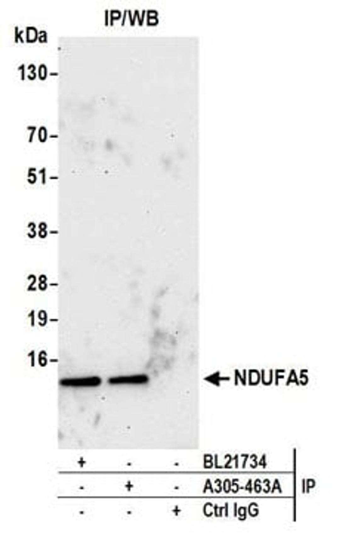 Detection of human NDUFA5 by western blot of immunoprecipitates.