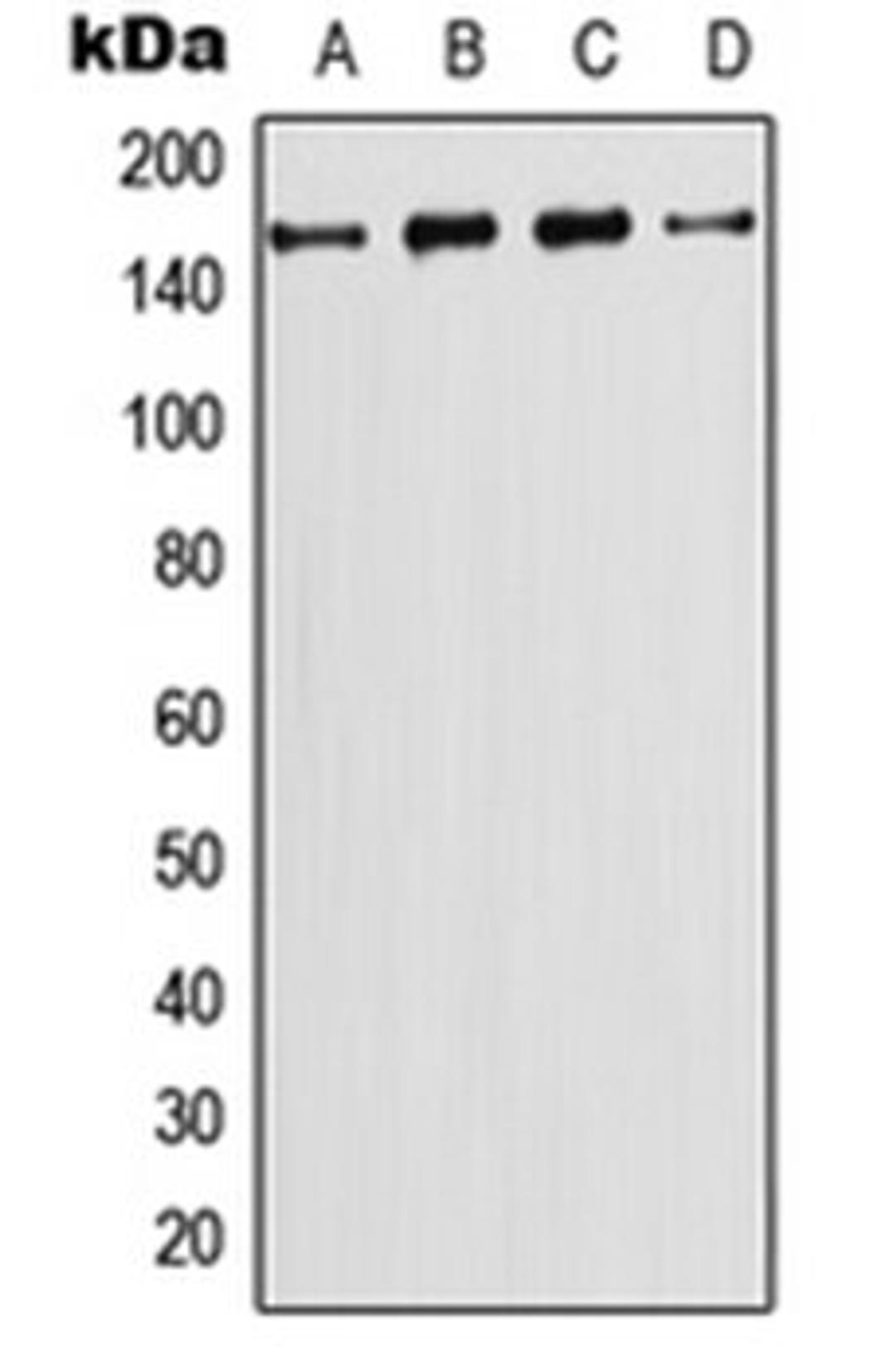 Western blot analysis of CEM (Lane 1), HeLa (Lane 2), NIH3T3 (Lane 3), PC12 (Lane 4) whole cell lysates using PIK3C2G antibody