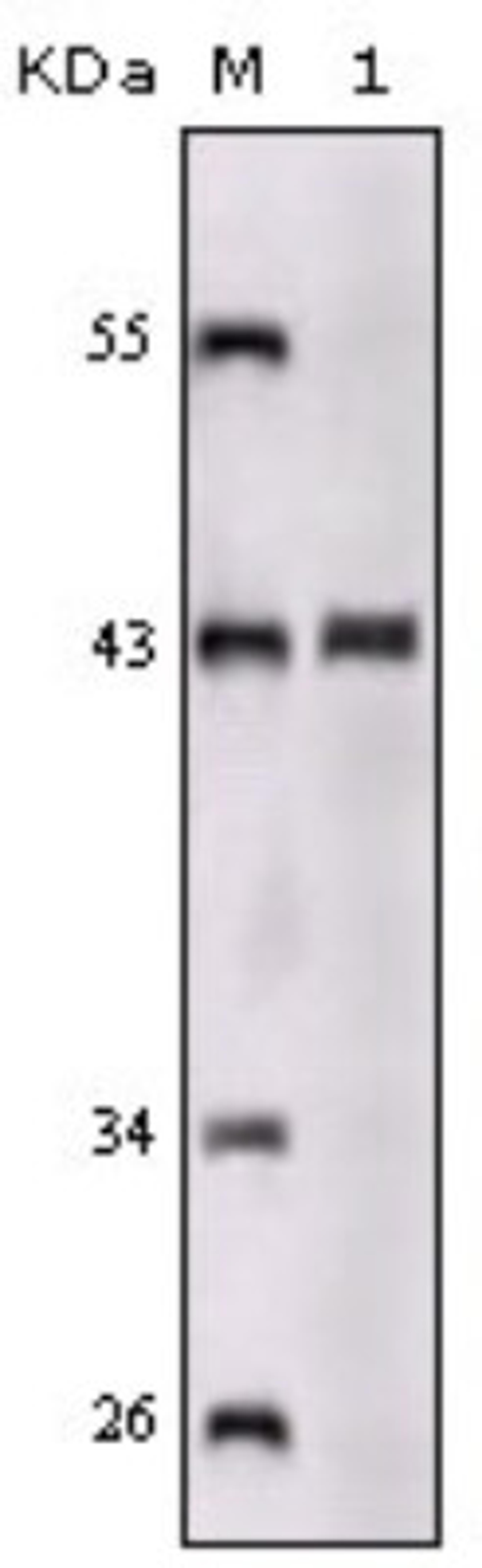 Western Blot: SorLA Antibody (3B6B11) [NBP1-28882] - Analysis using SORL1 mouse mAb against truncated SORL1 recombinant protein.