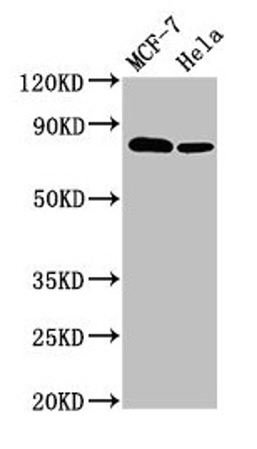 Western Blot. Positive WB detected in: MCF-7 whole cell lysate, Hela whole cell lysate. All lanes: BCAR1 antibody at 3.4µg/ml. Secondary. Goat polyclonal to rabbit IgG at 1/50000 dilution. Predicted band size: 94, 96, 78, 98 kDa. Observed band size: 78 kDa