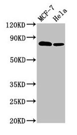 Western Blot. Positive WB detected in: MCF-7 whole cell lysate, Hela whole cell lysate. All lanes: BCAR1 antibody at 3.4µg/ml. Secondary. Goat polyclonal to rabbit IgG at 1/50000 dilution. Predicted band size: 94, 96, 78, 98 kDa. Observed band size: 78 kDa