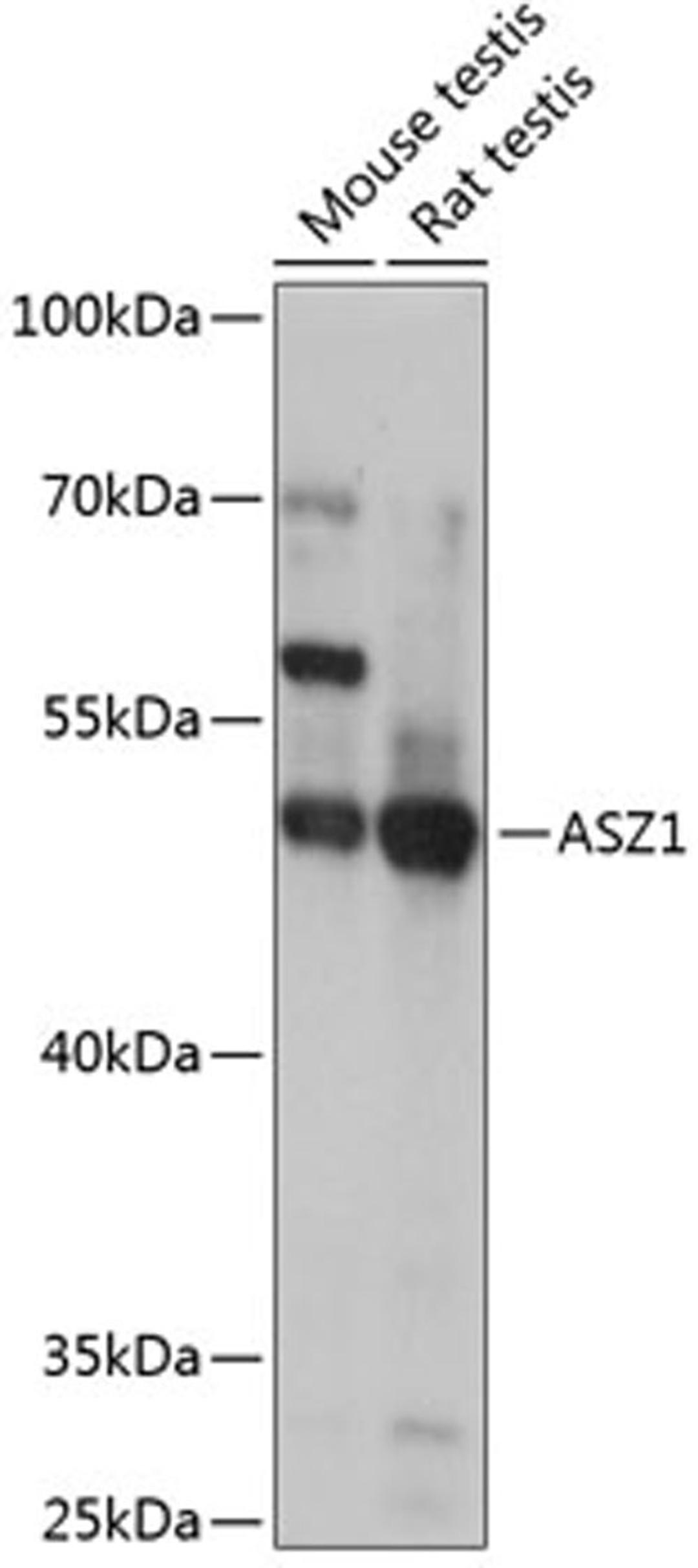 Western blot - ASZ1 antibody (A14447)