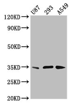 Western Blot. Positive WB detected in: U87 whole cell lysate, 293 whole cell lysate, A549 whole cell lysate. All lanes: VAX1 antibody at 3.8µg/ml. Secondary. Goat polyclonal to rabbit IgG at 1/50000 dilution. Predicted band size: 35, 22 kDa. Observed band size: 35 kDa