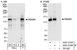 Detection of human RBM26 by western blot and immunoprecipitation.