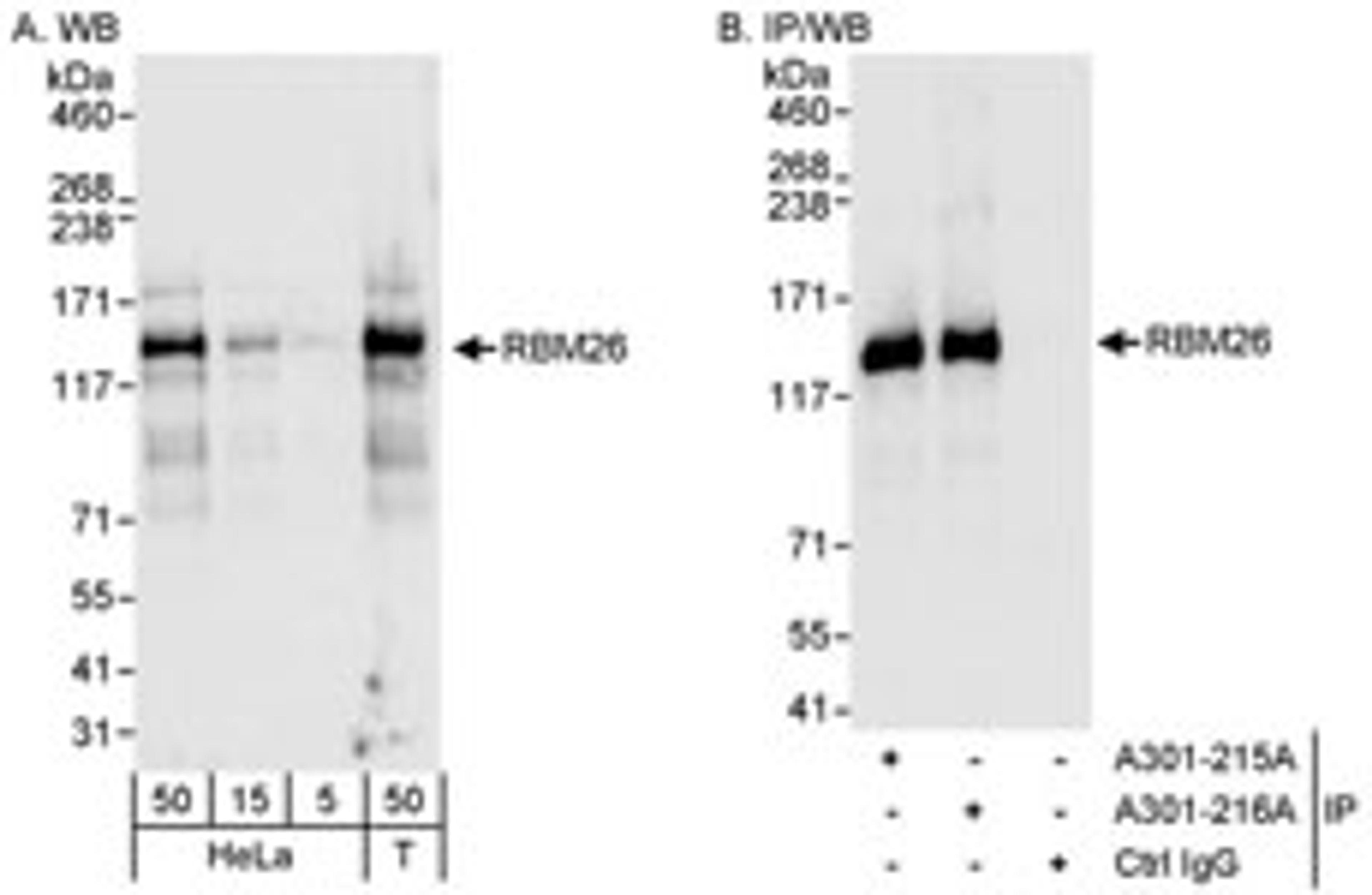 Detection of human RBM26 by western blot and immunoprecipitation.