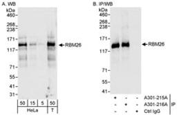 Detection of human RBM26 by western blot and immunoprecipitation.