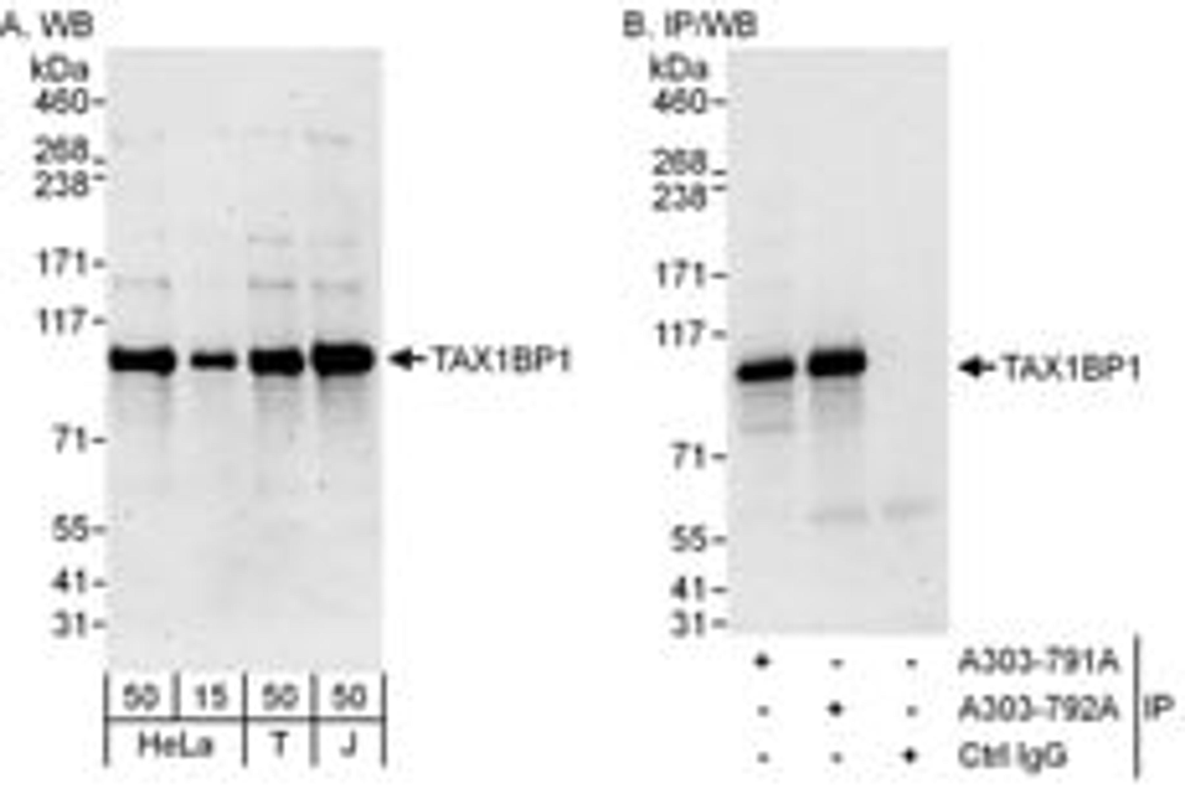 Detection of human TAX1BP1 by western blot and immunoprecipitation.