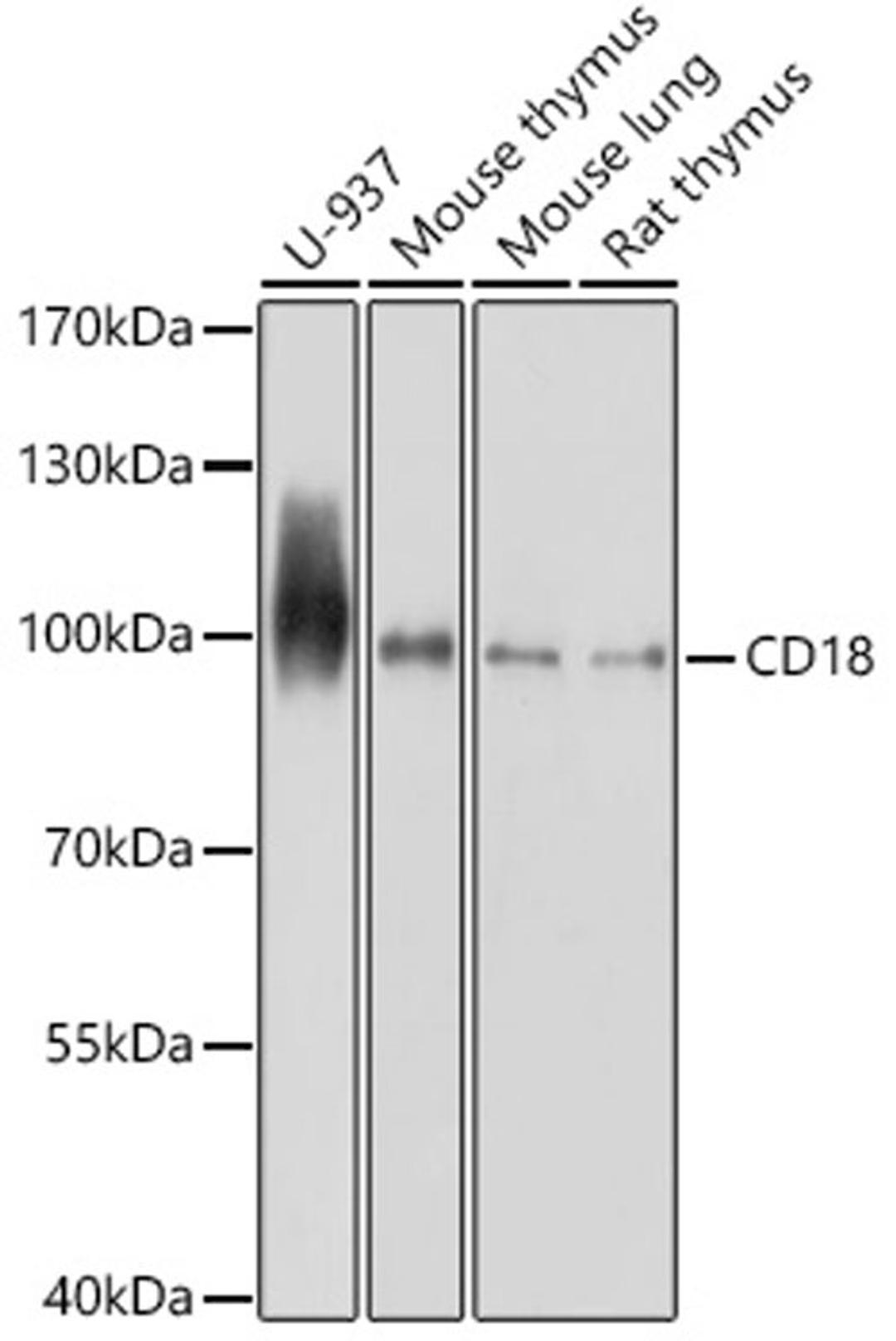 Western blot - CD18 antibody (A2173)