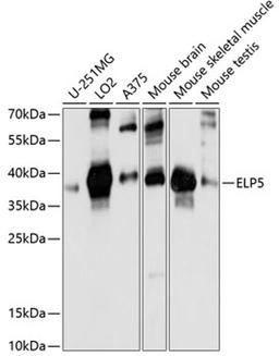 Western blot - ELP5 antibody (A14862)