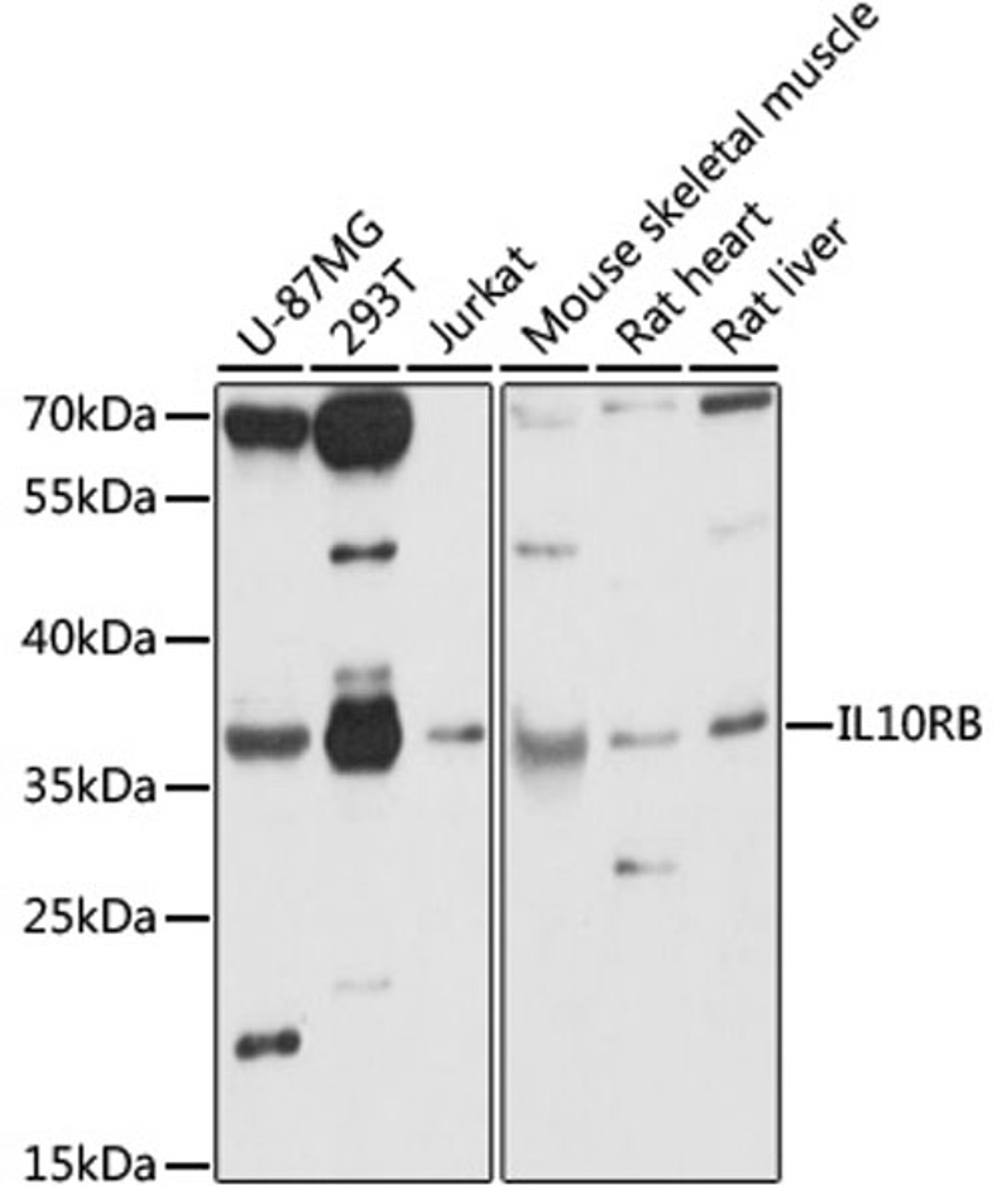 Western blot - IL10RB antibody (A15680)