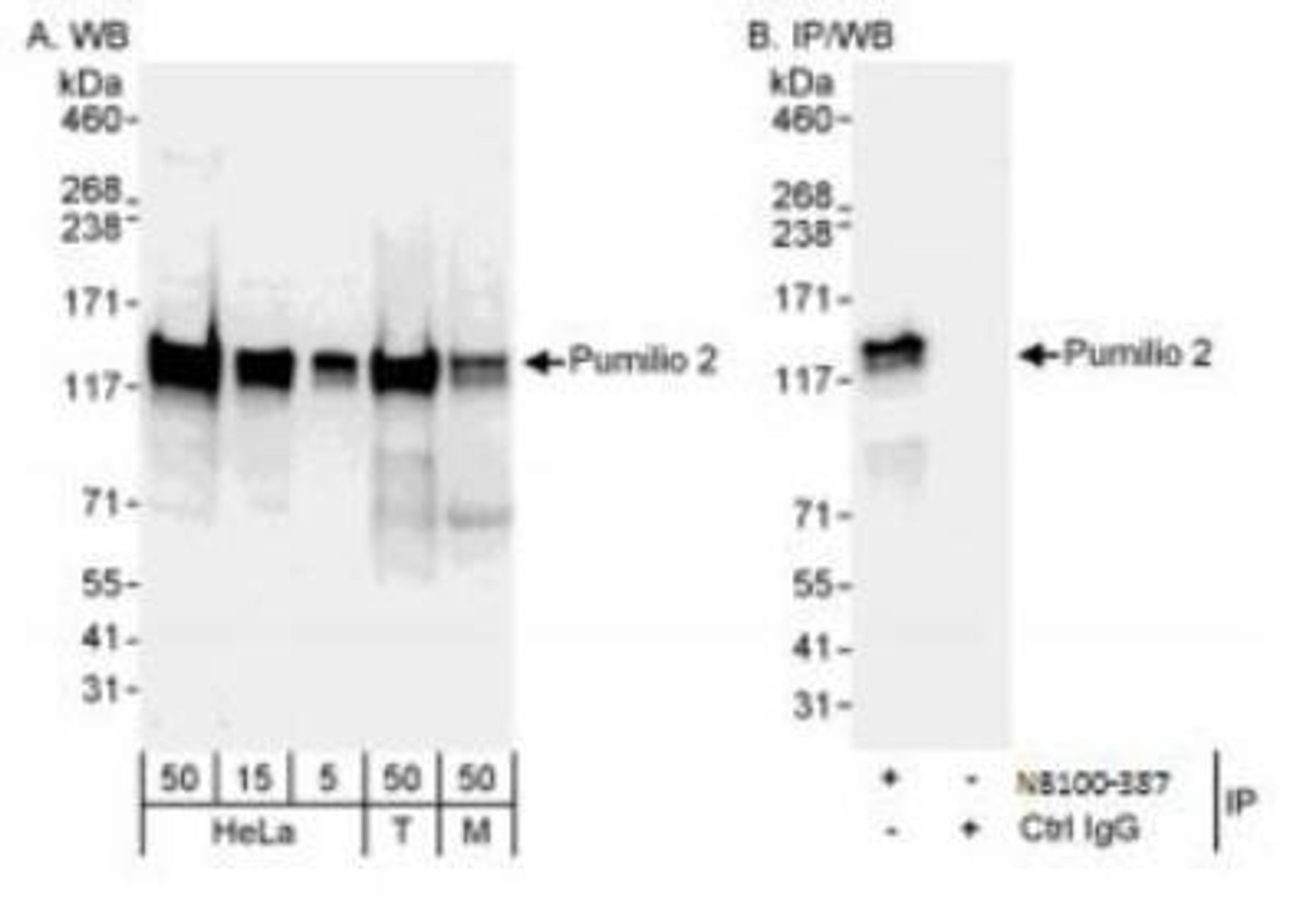 Western Blot: Pumilio 2 Antibody [NB100-387] - Detection of Human and Mouse Pumilio 2 by Western Blot (h&m) and Immunoprecipitation (h).  Samples: Whole cell lysate from HeLa (5, 15 and 50 ug for WB; 1 mg for IP, 20% of IP loaded), 293T (T; 50 ug), and mouse NIH3T3 (M; 50 ug) cells. Antibodies:  Affinity purified rabbit anti-Pumilio 2 antibody NB100-387 used for WB at 0.2 ug/ml (A) and 1 ug/ml (B) and used for IP at 3 ug/mg lysate.