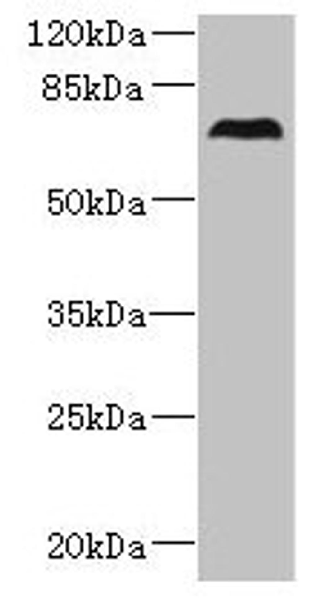 Western blot. All lanes: CEP76 antibody at 0.5µg/ml + 293T whole cell lysate. Secondary. Goat polyclonal to rabbit IgG at 1/10000 dilution. Predicted band size: 75, 66, 30 kDa. Observed band size: 75 kDa