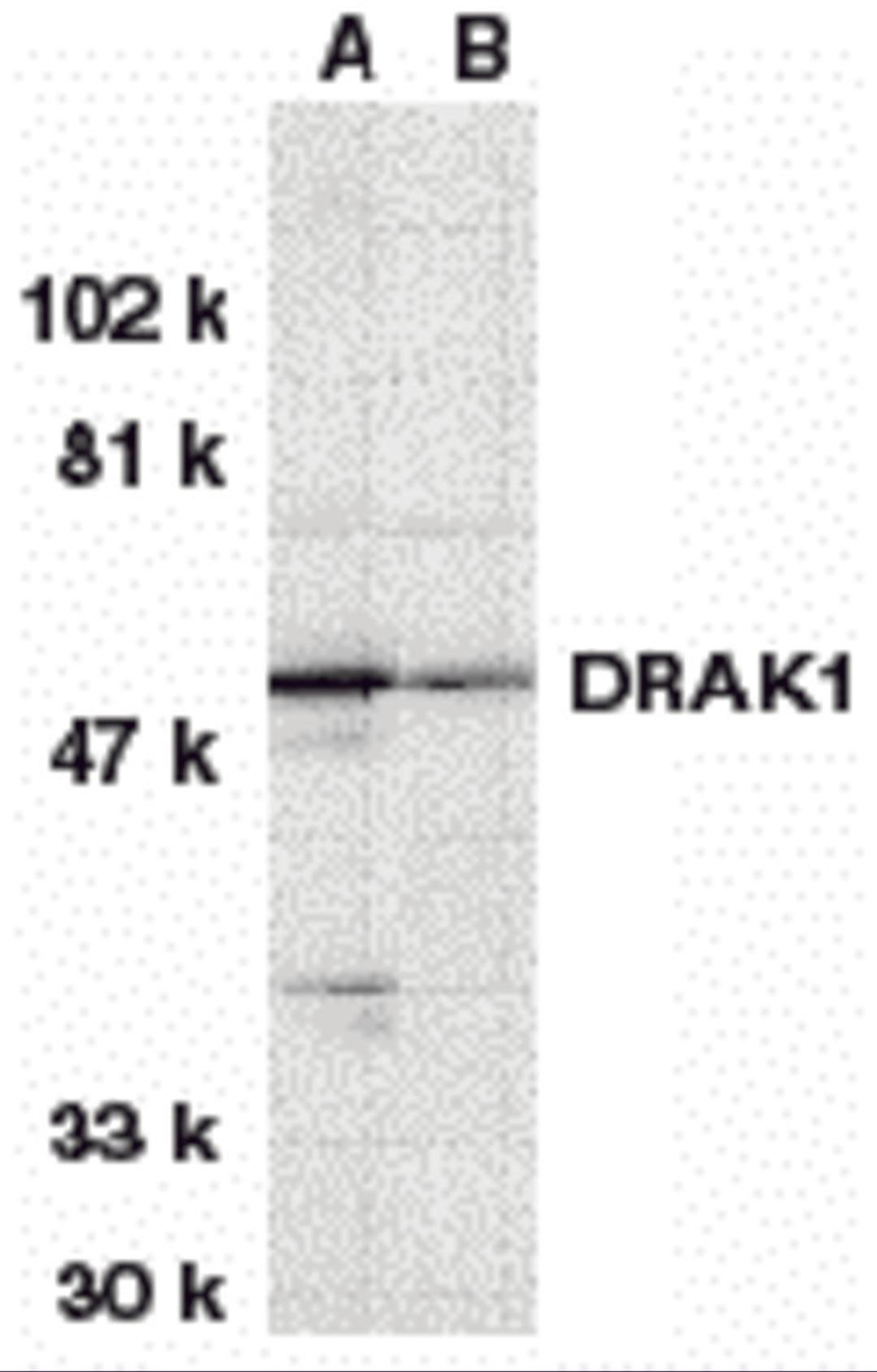 Western blot analysis of DRAK1 in (A) MOLT4 and (B) A431 whole cell lysates with DRAK1 antibody at 1 μg/mL.