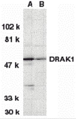 Western blot analysis of DRAK1 in (A) MOLT4 and (B) A431 whole cell lysates with DRAK1 antibody at 1 μg/mL.