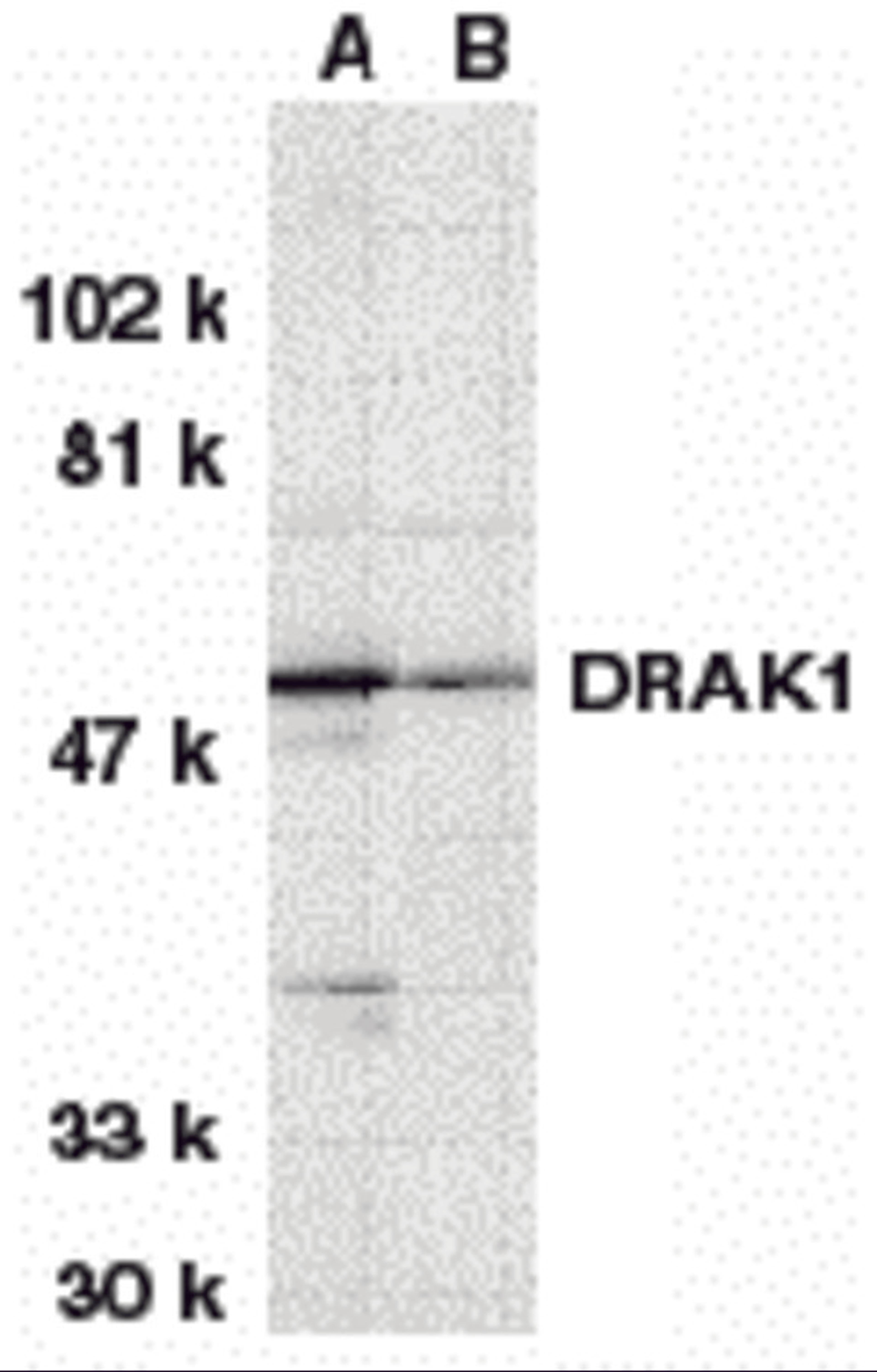 Western blot analysis of DRAK1 in (A) MOLT4 and (B) A431 whole cell lysates with DRAK1 antibody at 1 μg/mL.