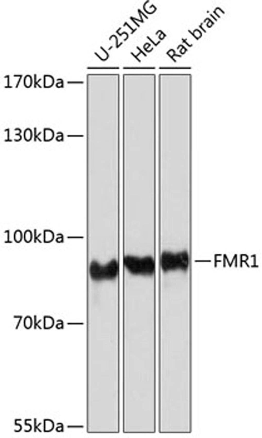 Western blot - FMR1 antibody (A6092)