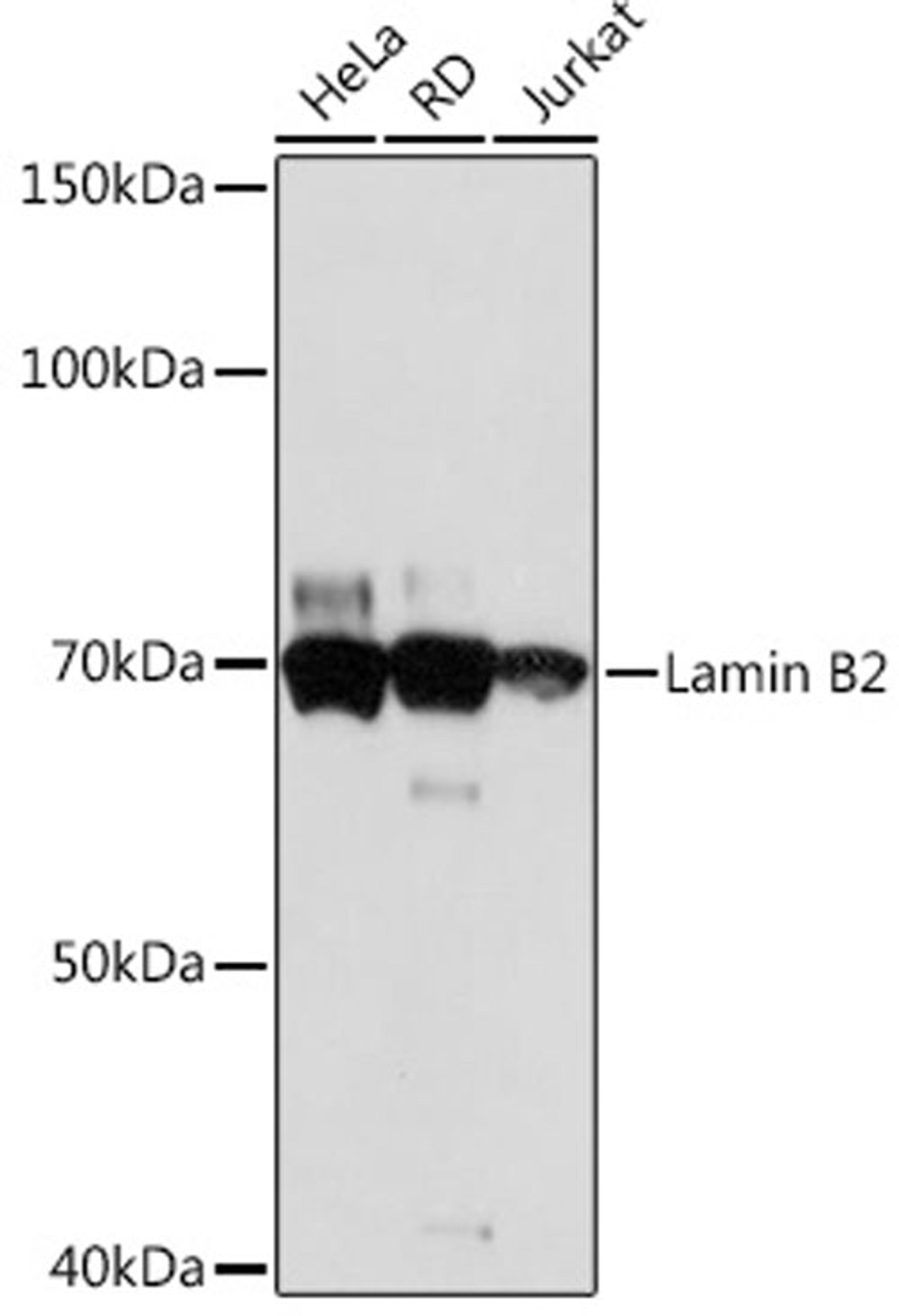 Western blot - Lamin B2  Rabbit mAb (A5001)