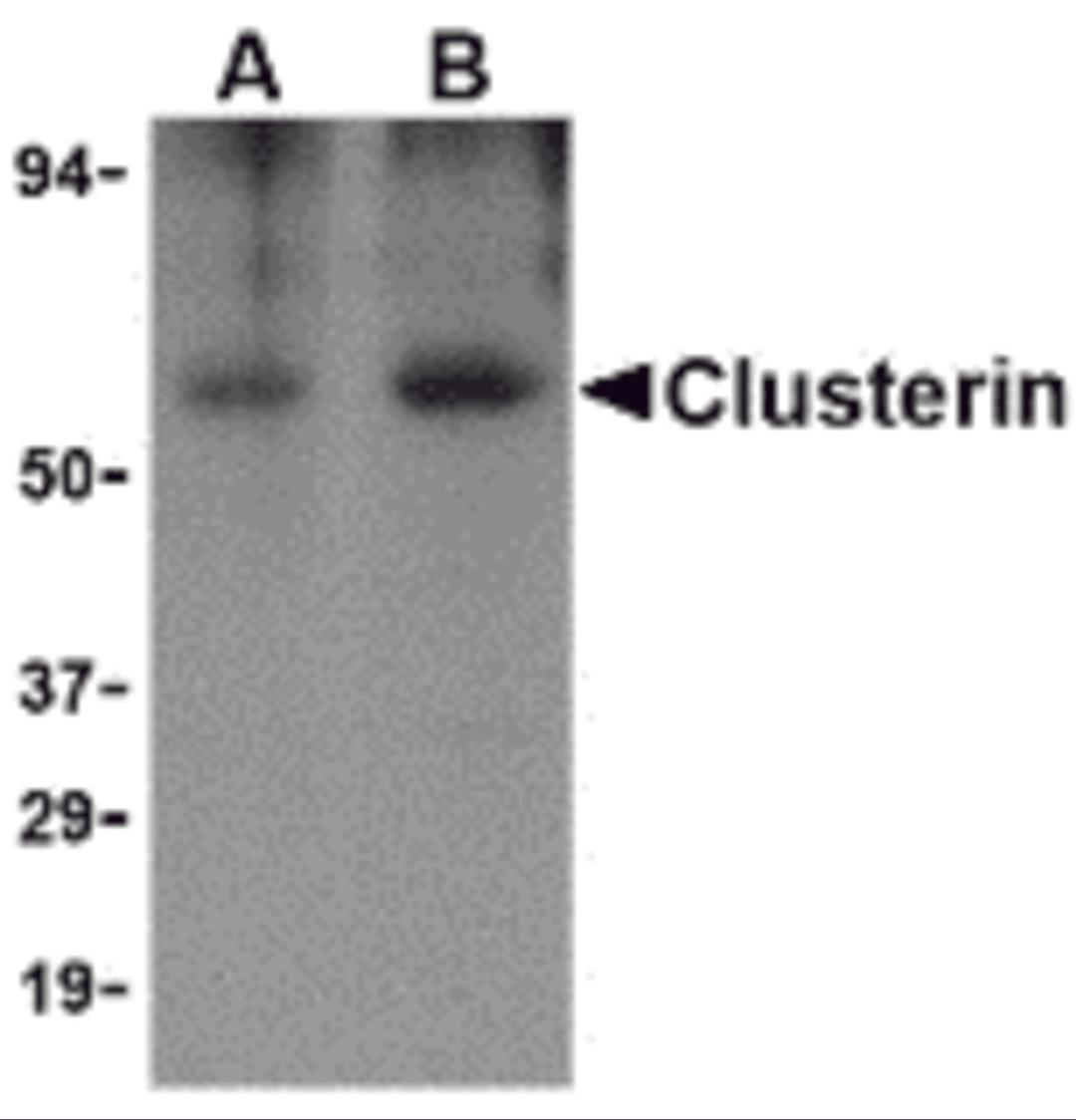 Western blot analysis of Clusterin in human brain tissue lysate with Clusterin body at (A) 0.5 and (B) 1 &#956;g/mL.