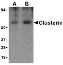 Western blot analysis of Clusterin in human brain tissue lysate with Clusterin body at (A) 0.5 and (B) 1 μg/mL.